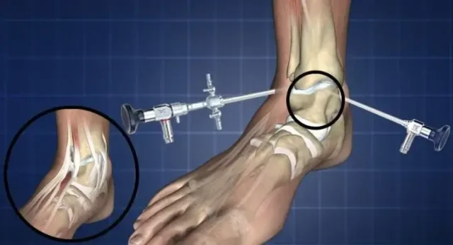 Anasayfa 31 Mozaikoplasti Nedir