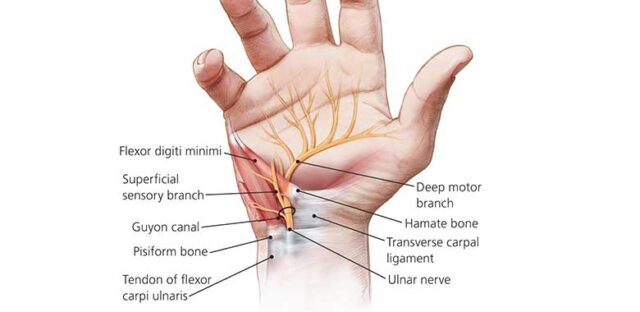 Blog 4 Flexor Tendon Yaralanmalari