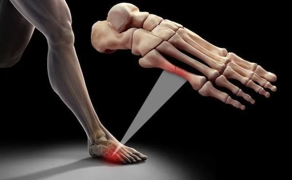 Anasayfa 32 stres kiriklari 600x371 1